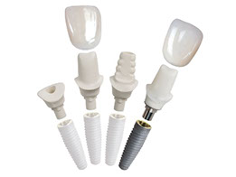 Tipos de implantes dentales
