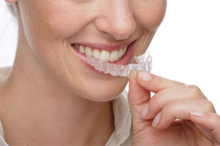 Invisalign