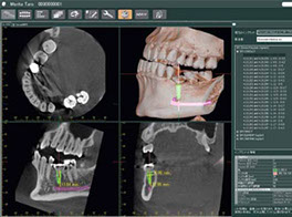 Cirugía guiada por ordenador